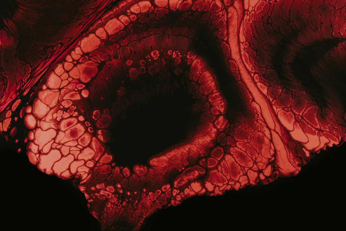 Reconhecer a essência mitopoética de nossa alma é fundamental no processo analítico. Sem poesia e sem histórias, é impossível, para o ser humano, encontrar propósito no sofrimento, impossível suportá-lo e superá-lo.